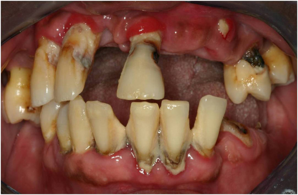 dental oral hygiene